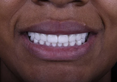 Before-and-after-photos-2JPG-scaled Before-and-after-photos-2JPG-scaled