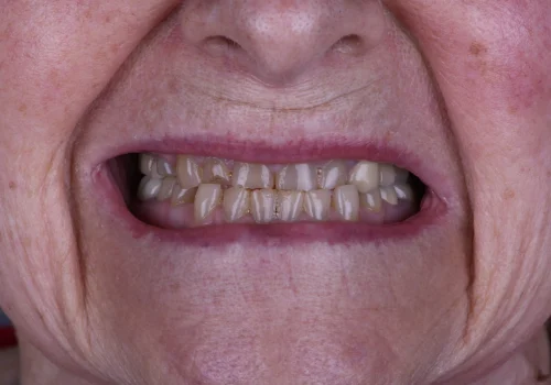 Before-and-after-photos-3JPG-scaled Before-and-after-photos-3JPG-scaled
