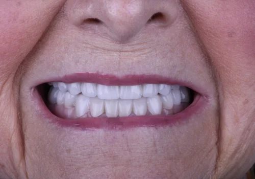 Before-and-after-photos-4JPG-scaled Before-and-after-photos-4JPG-scaled